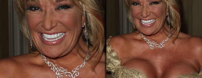 Tanya Tucker Plastic Surgery